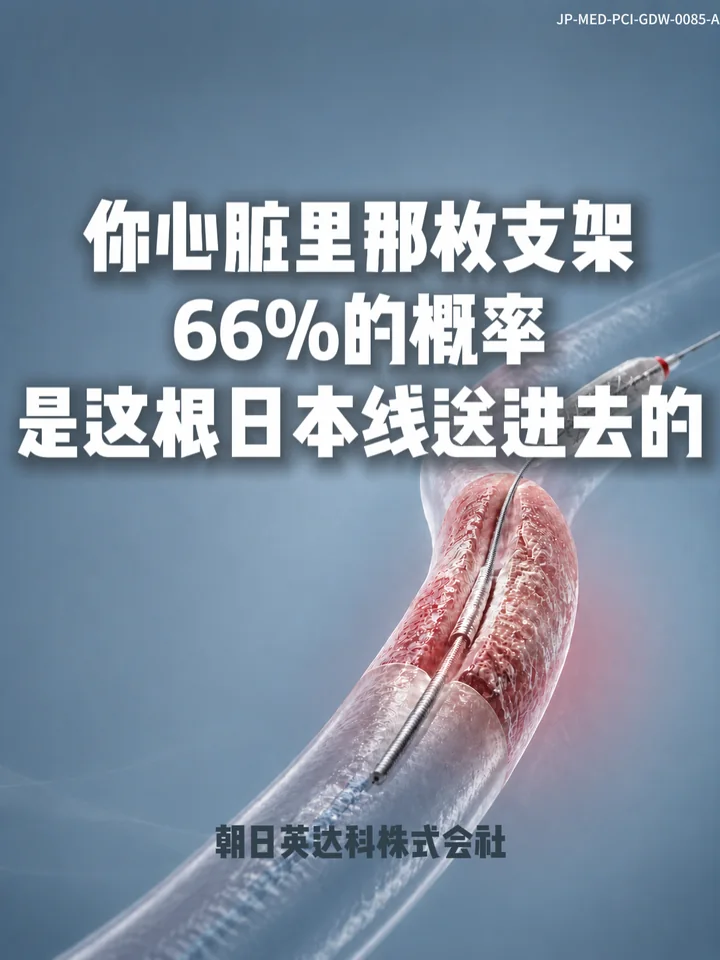 IF-V0085 给心脏里那枚支架，66%的概率，是这根日本线送进去的 视频封面